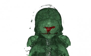 Dibujan-el-mapa-de-los-interruptores-geneticos-que-modelan-el-rostro_image_380