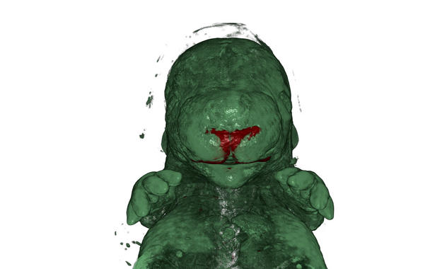 Dibujanelmapadelosinterruptoresgeneticosquemodelanelrostroimage380 El Digital de Asturias