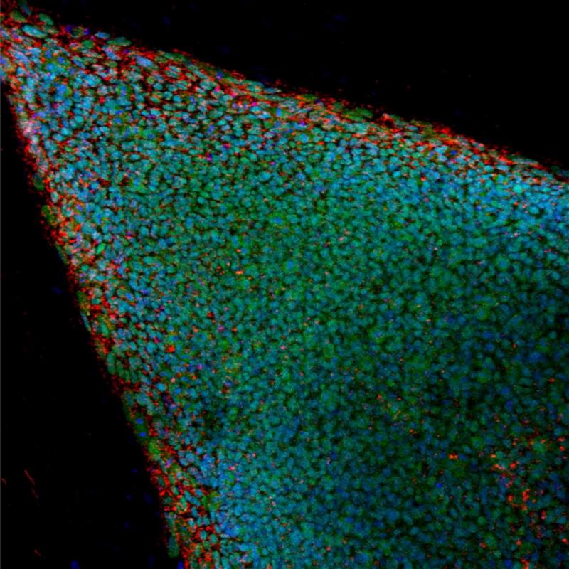 5785012w El Digital de Asturias