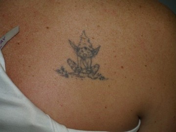 1435573416_gnomo_antes_p