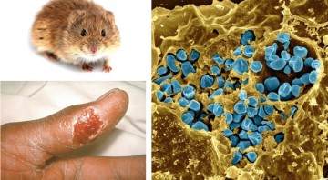 Los-casos-de-tularemia-en-humanos-se-disparan-durante-los-anos-de-plaga-de-topillo_image800_