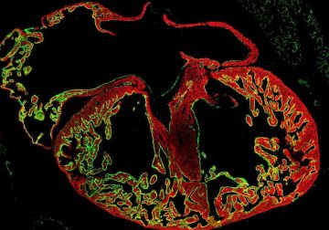 fotonoticia_20151207170036_800