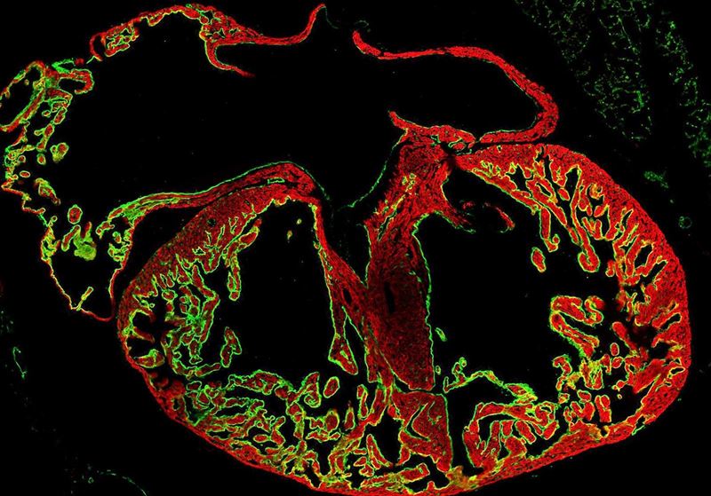 fotonoticia20151207170036800 El Digital de Asturias