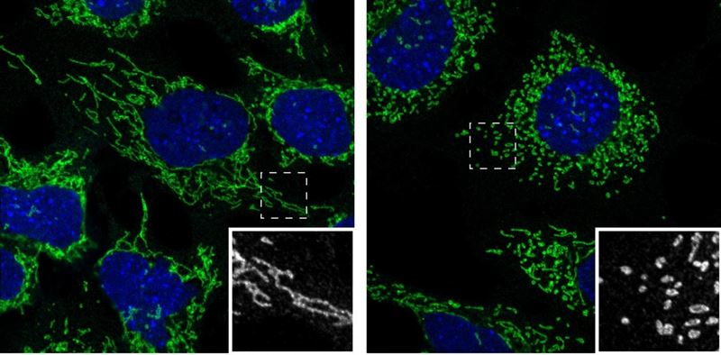 fotonoticia20160118084835800 El Digital de Asturias