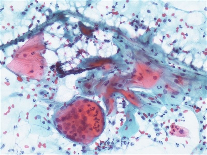 fotonoticia20160428074333800 El Digital de Asturias