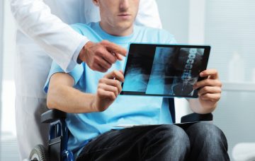 Doctor showing X-ray to patient