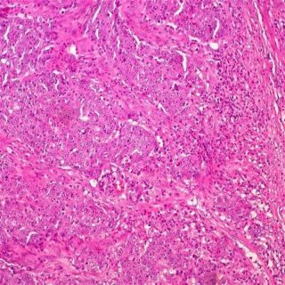 fotonoticia_20160606080635_800