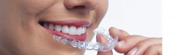 Ortodoncia_Invisalign_Alineadores