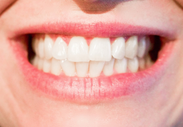 ndpsaludsonrisa El Digital de Asturias