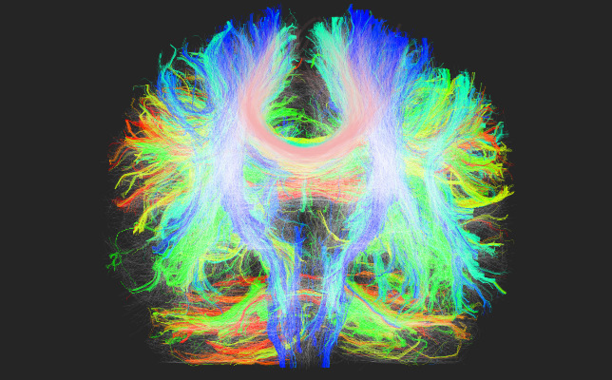 Descubrenunbiomarcadorcapazdedetectarlafaseinicialdelparkinsonimage380 El Digital de Asturias