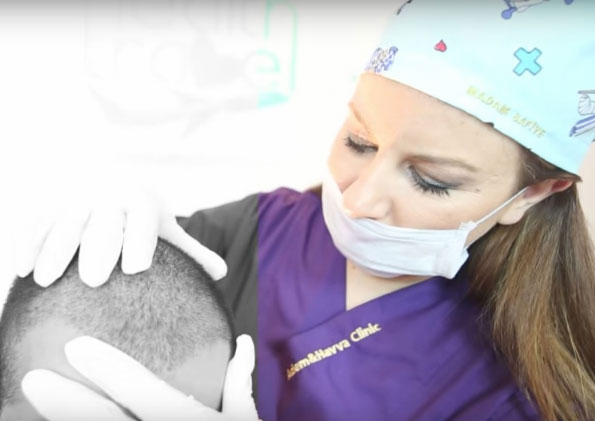 ndpimplantepelo El Digital de Asturias