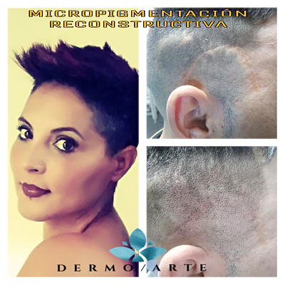 DermoarteIP El Digital de Asturias