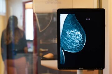 cancer El Digital de Asturias Salud Tendencias