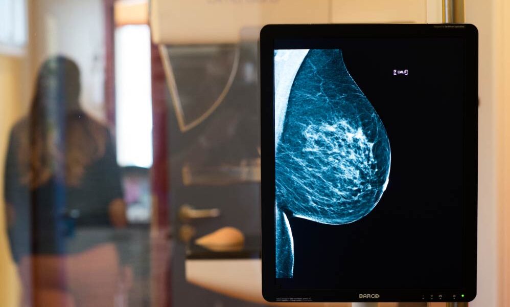 cancer El Digital de Asturias Salud Tendencias