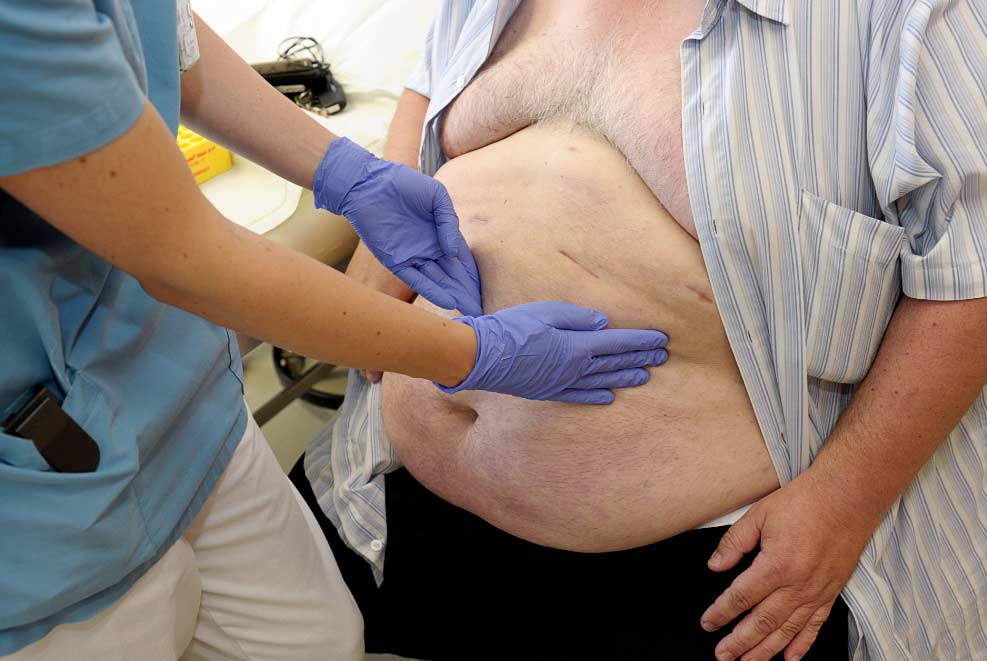 Síndromemetabólico El Digital de Asturias Síndrome metabólico